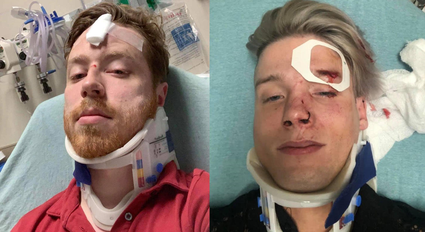 $20,000 raised for Texas gay couple beaten for holding hands