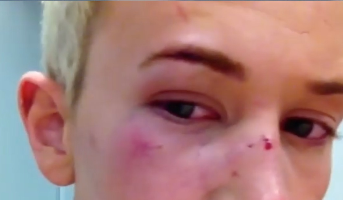 X Factor singer Bradley Hunt opens up about homophobic abuse