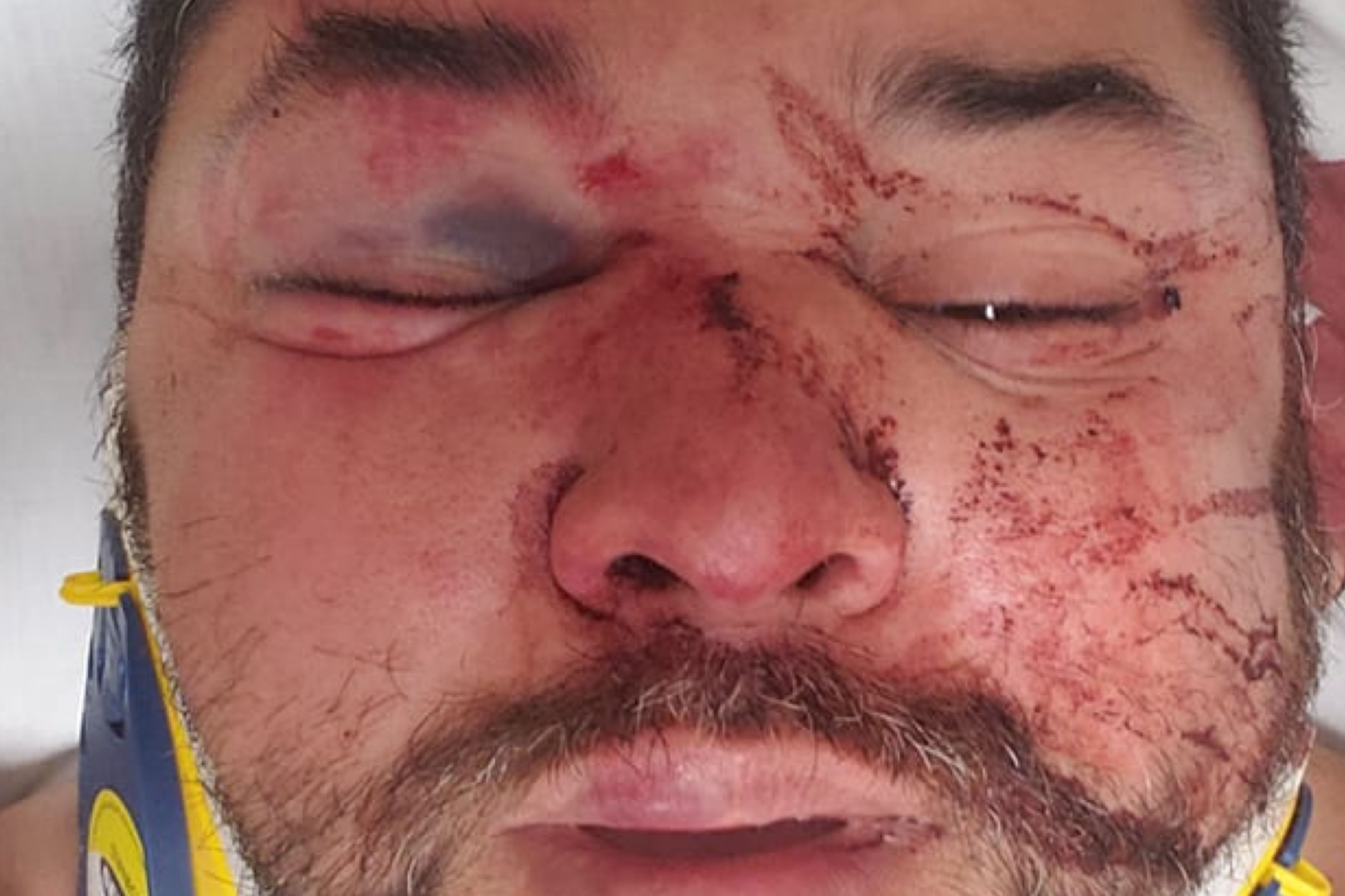 Phoenix gay man 'attacked by mob of 10 people'