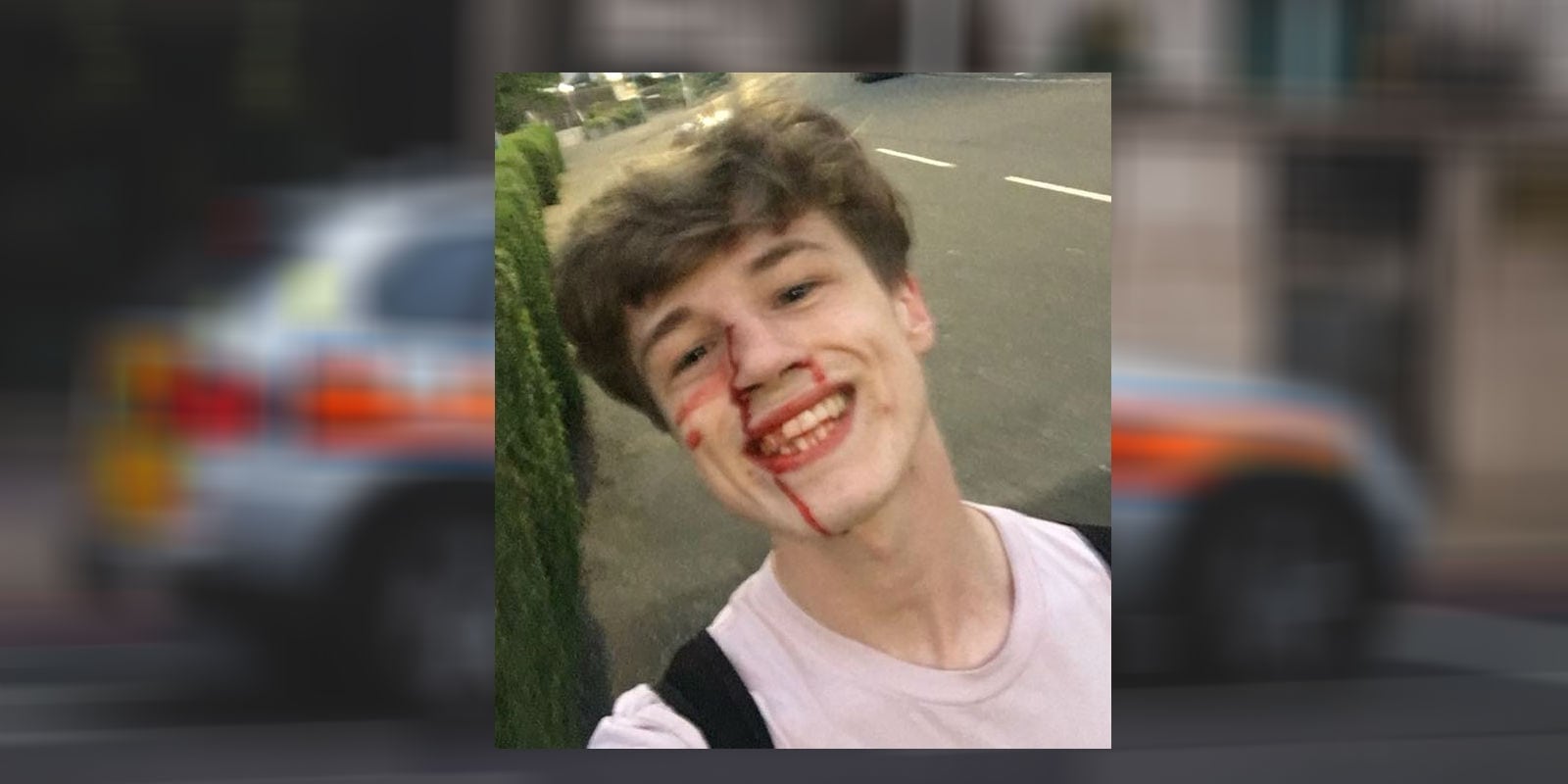 Police seek witnesses to homophobic attack that led to viral smiling selfie