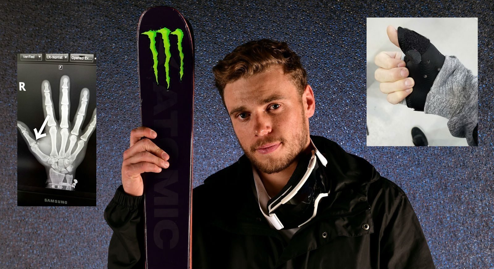 Gay Olympic skier Gus Kenworthy breaks his thumb, jokes about avoiding Mike Pence handshake