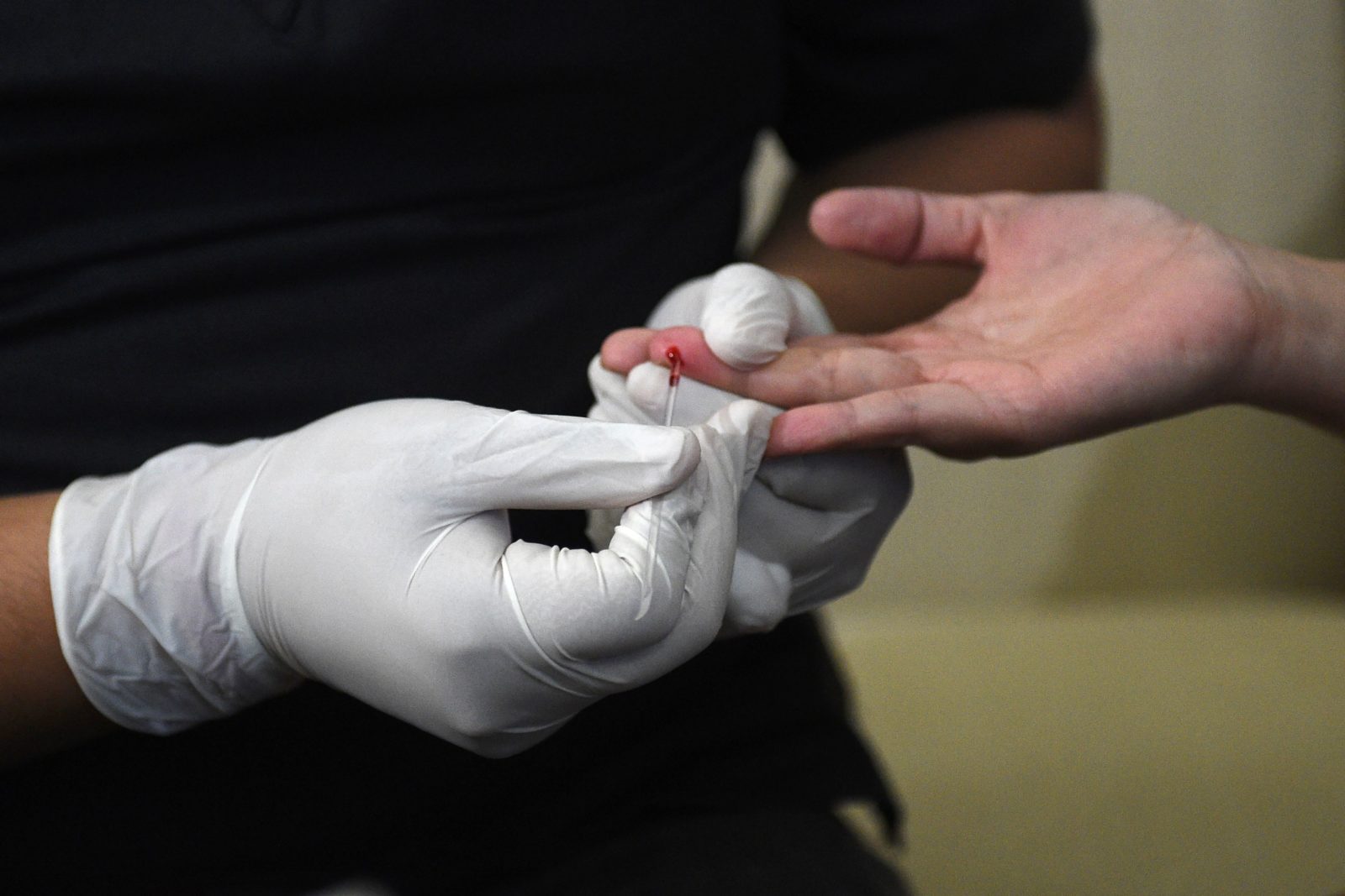 What is HTLV-1? The virus which is a 'distant cousin of HIV'