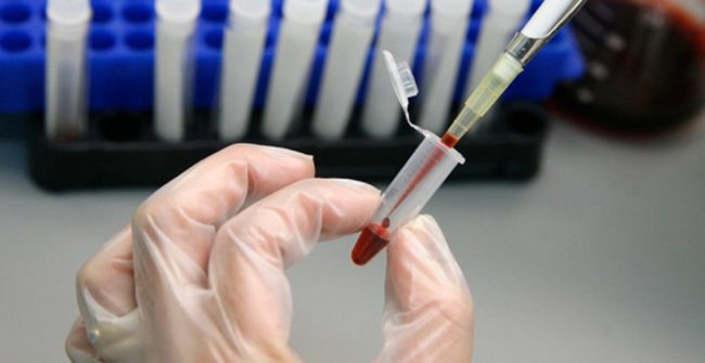 Online HIV programme featuring interactive games reduces STIs in gay young men by 40%