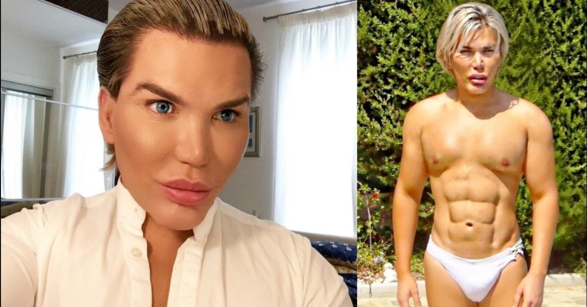 Human Ken Doll Rodrigo Alves quits Celebrity Big Brother to have ribs removed