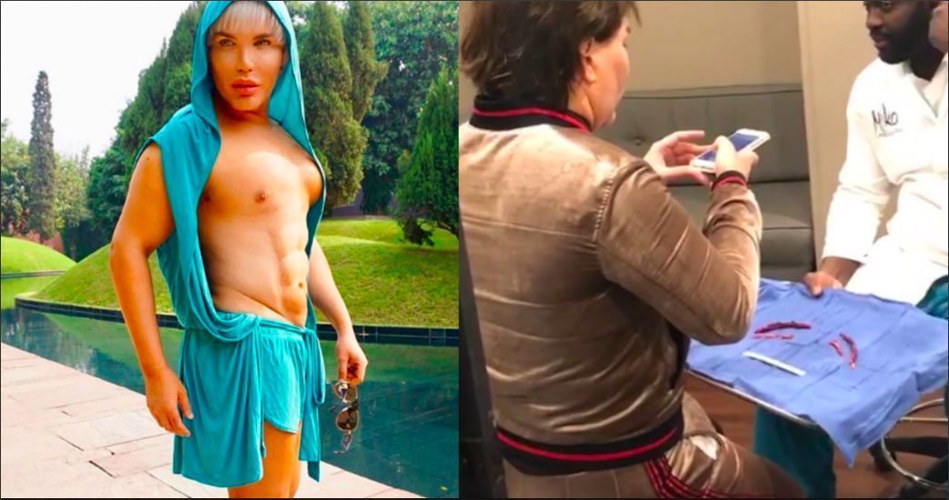 Human Ken Doll Rodrigo Alves becomes world's first man to have four ribs removed