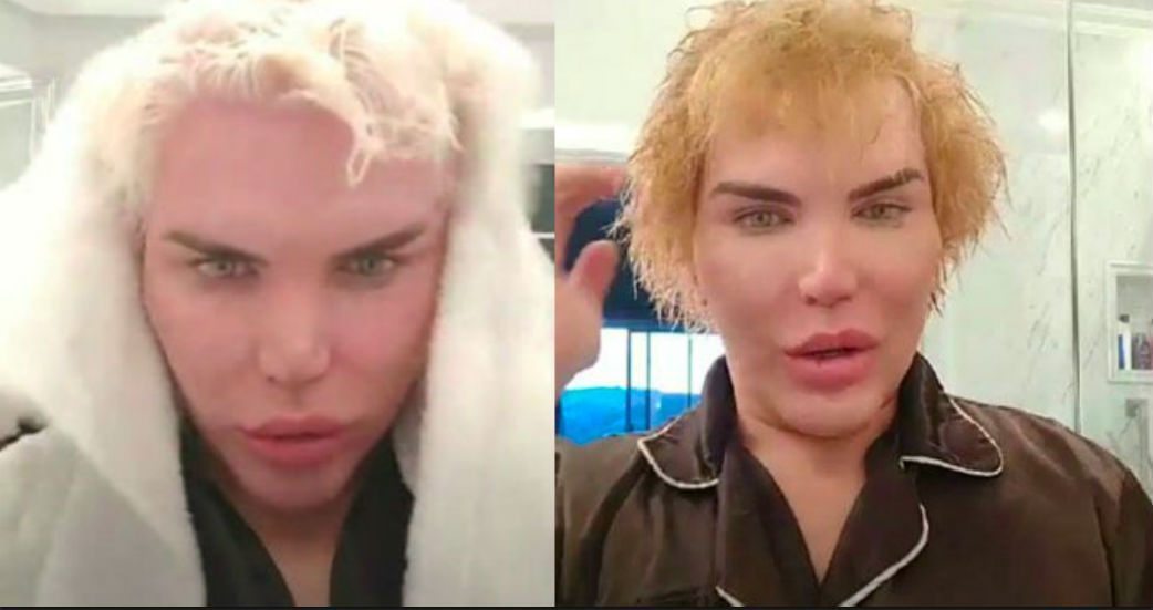 Human Ken Doll Rodrigo Alves reveals where his ribs will be stored