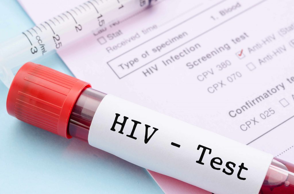 HIV-positive patient wins $18 million in damages in malpractice lawsuit