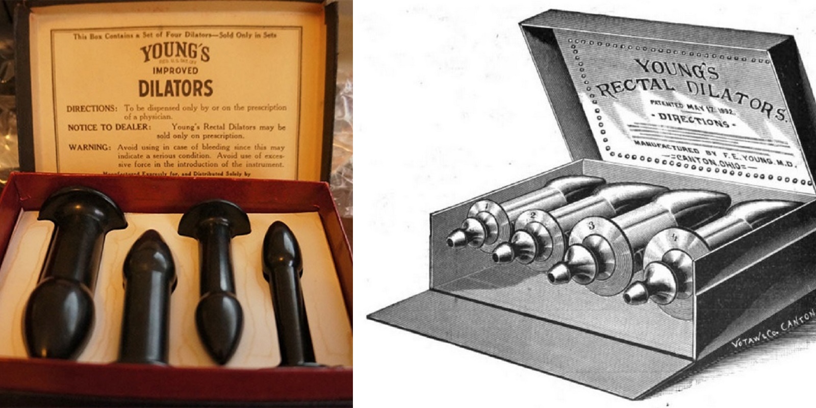 Butt plugs used to be sold as a 'miracle cure' for headaches and acne