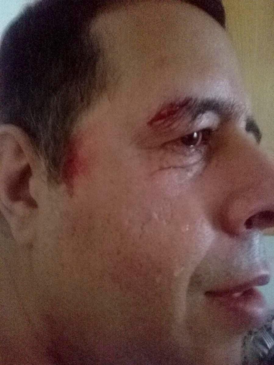 Gay couple suffer brain injury and facial fracture after brutal attack in London