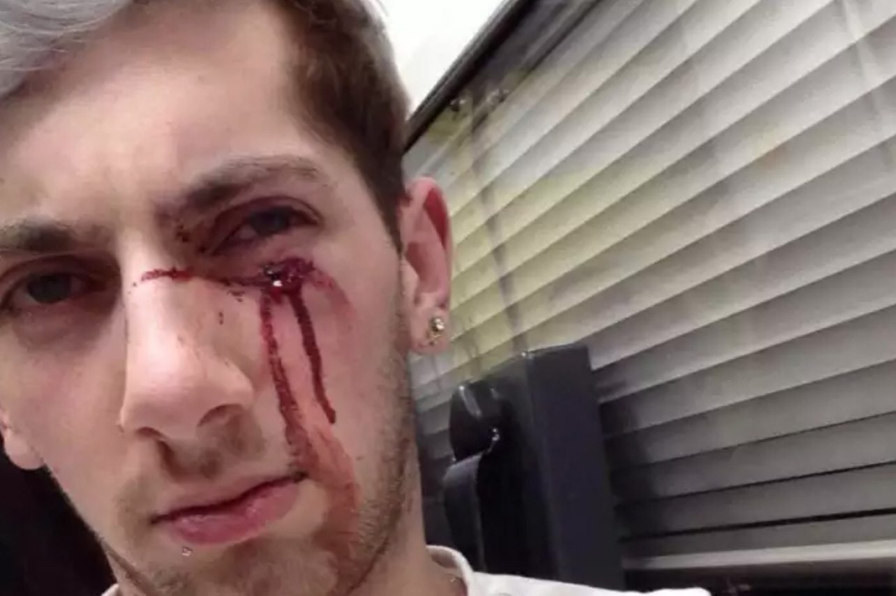 Three people hospitalised after horrific 'homophobic attack' in Blackpool