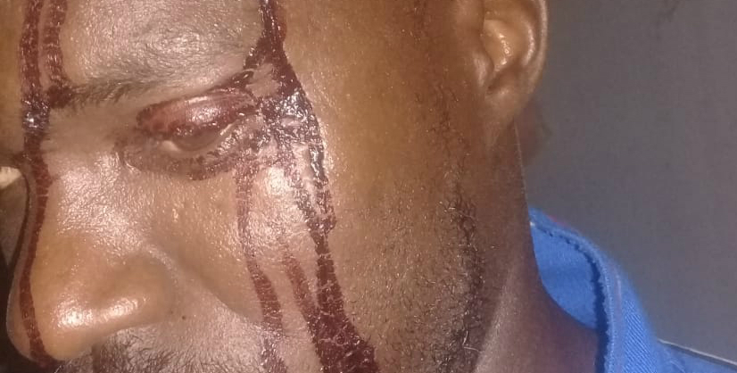 LGBT+ activists attacked on peaceful march in Kenya refugee camp