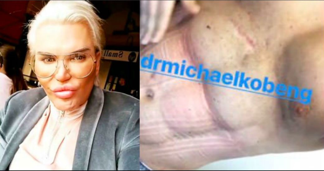 Human Ken Doll Rodrigo Alves admits taking bones as he reveals new waistline