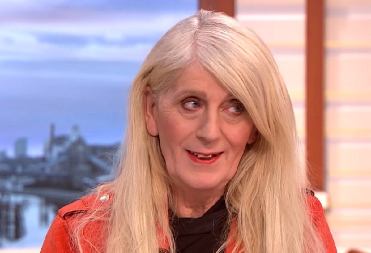 Trans lottery winner Melissa Ede spends thousands on transforming her face