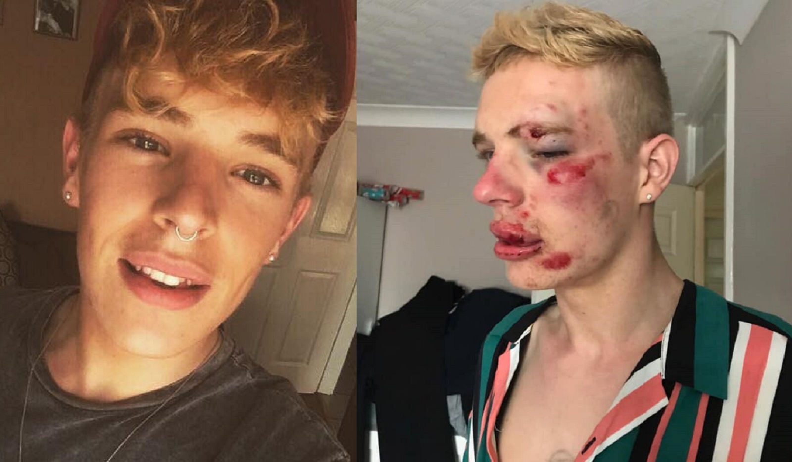 Gay man left with horrific injuries after homophobic attack outside McDonald's