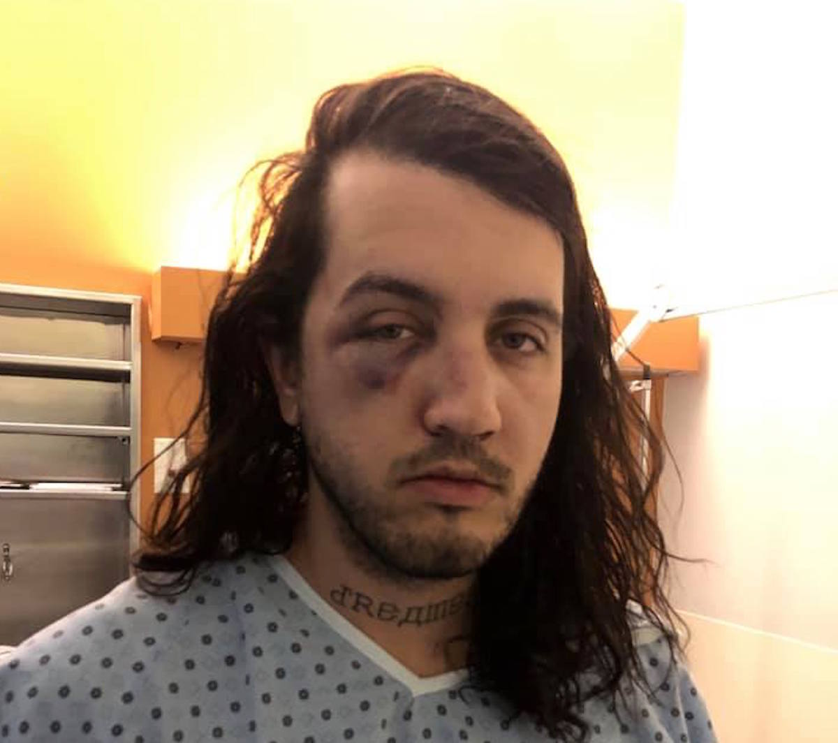 Fashion designer and boyfriend beaten in 'homophobic' attack