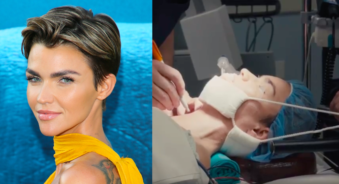 Ruby Rose undergoes emergency surgery after stunt accident nearly left her paralysed