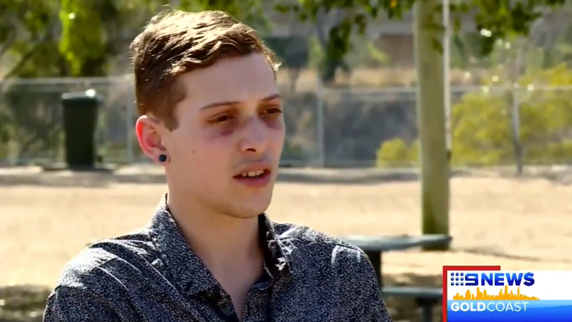 Gay man and teen brother attacked by 'bloodthirsty' thugs in anti-gay attack at Westfield