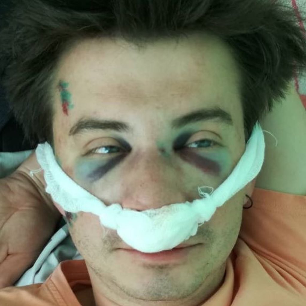 Belarus filmmaker hospitalised after brutal anti-gay attack