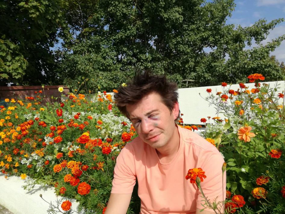 Belorussian filmmaker Nikolai Kuprich suffered a broken nose and severe head injuries