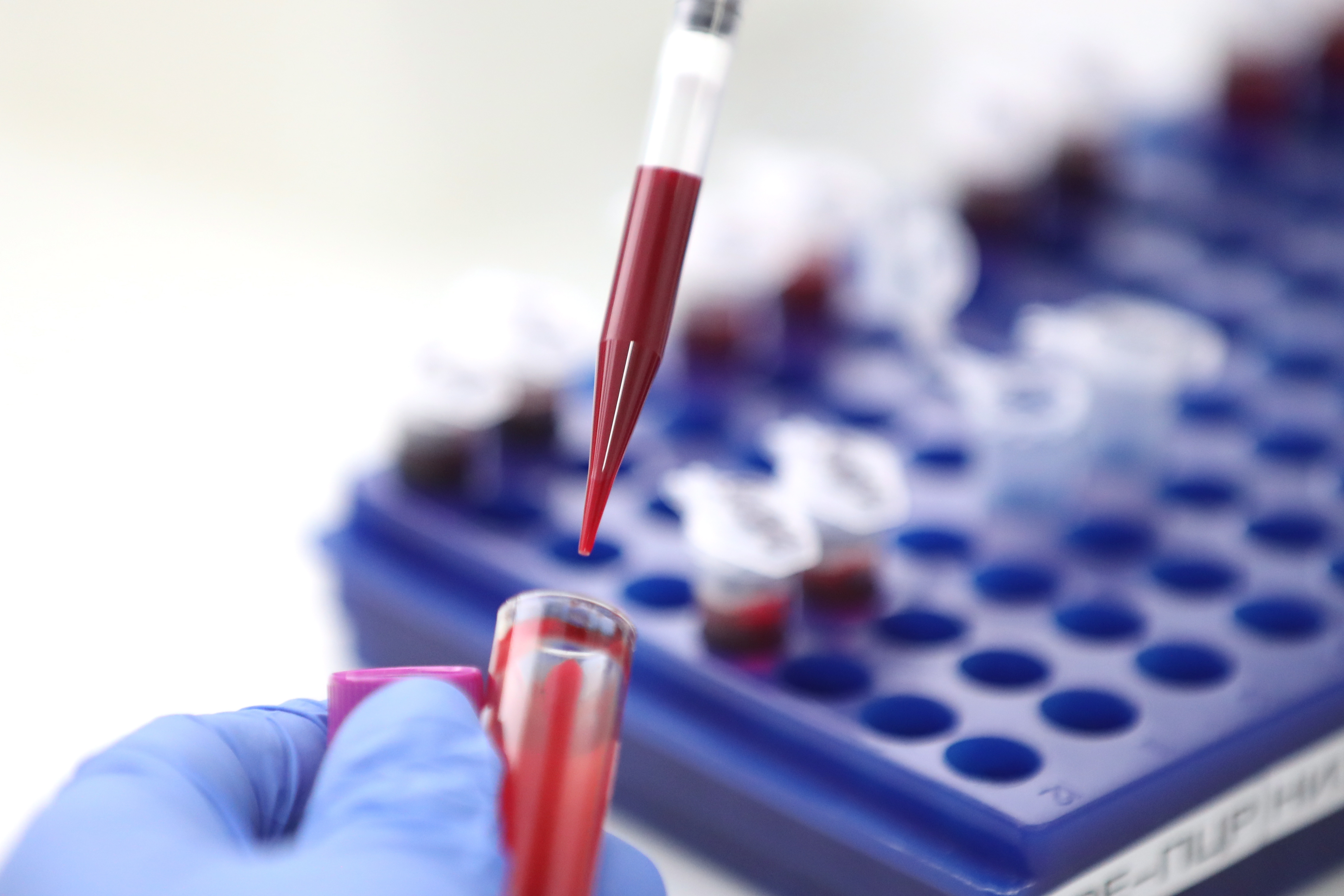 Scientists just discovered a rare gene that gives people immunity to HIV