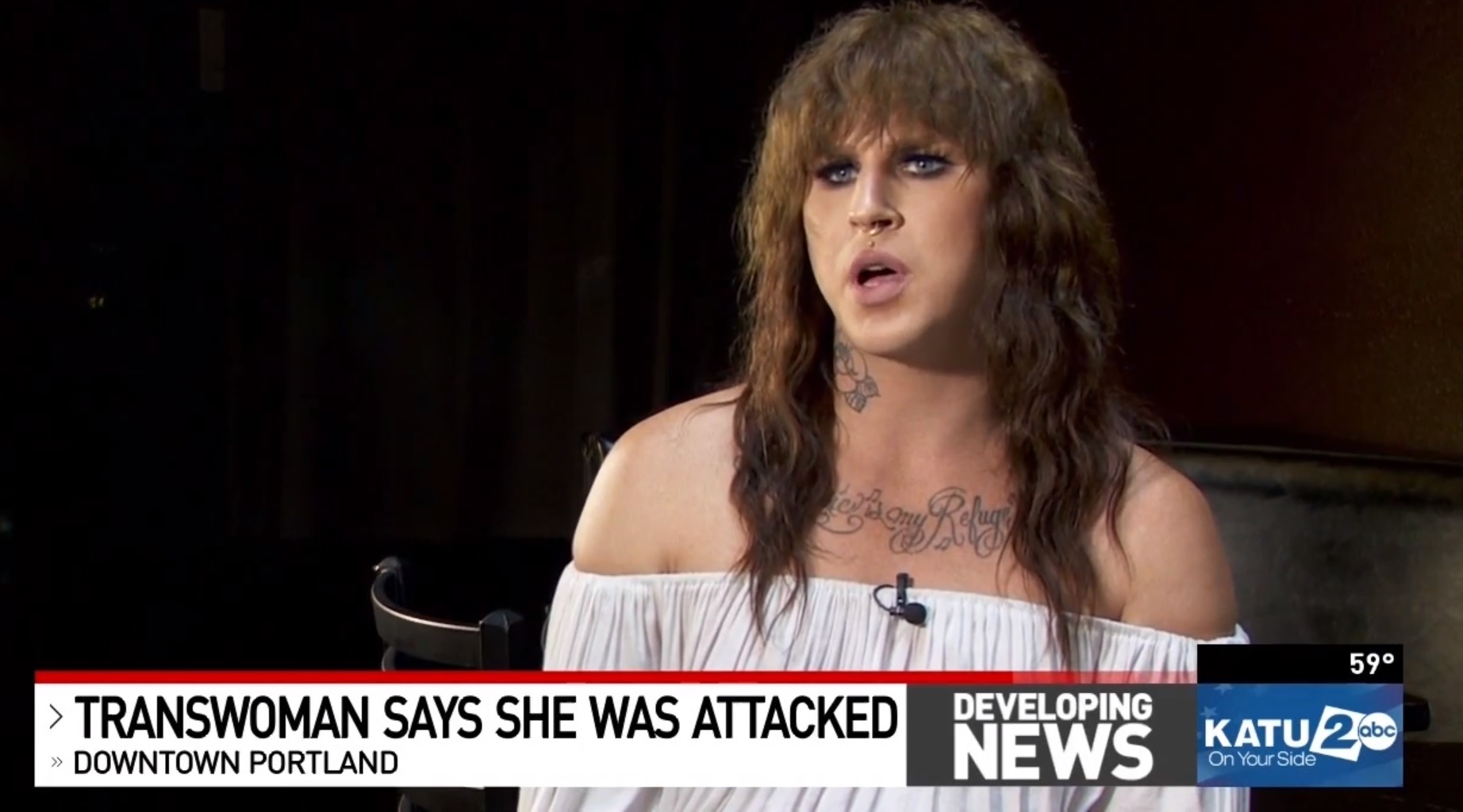 Trans woman says she was 'on the ground bleeding' after suspected transphobic attack