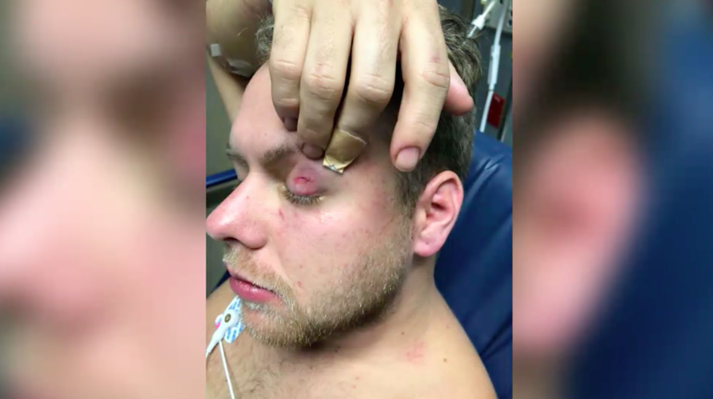 Gay couple claim they were beaten in vicious and unprovoked attack by men claiming to be police