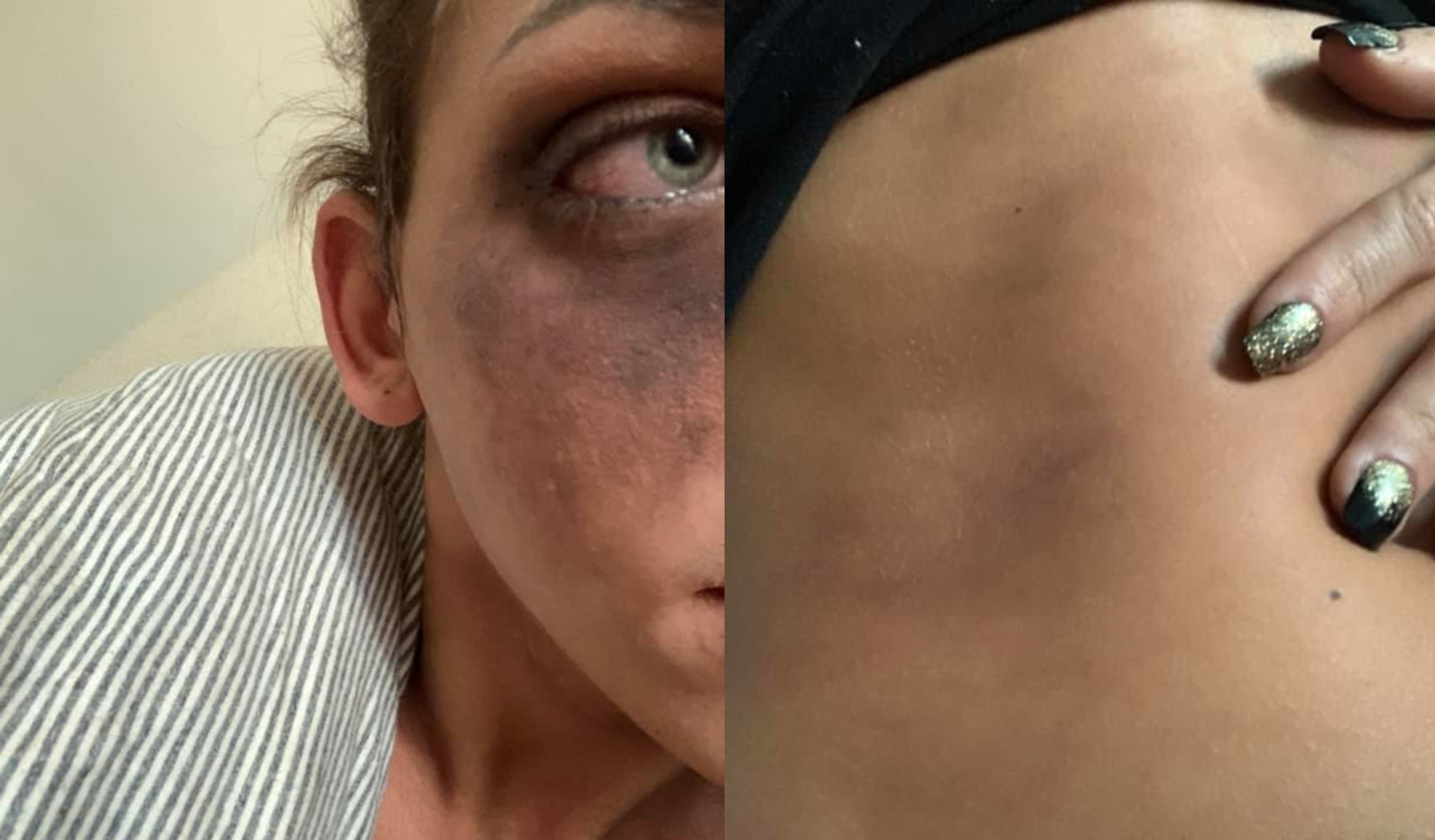 Trans woman claims she was violently attacked while a police officer watched on and did nothing