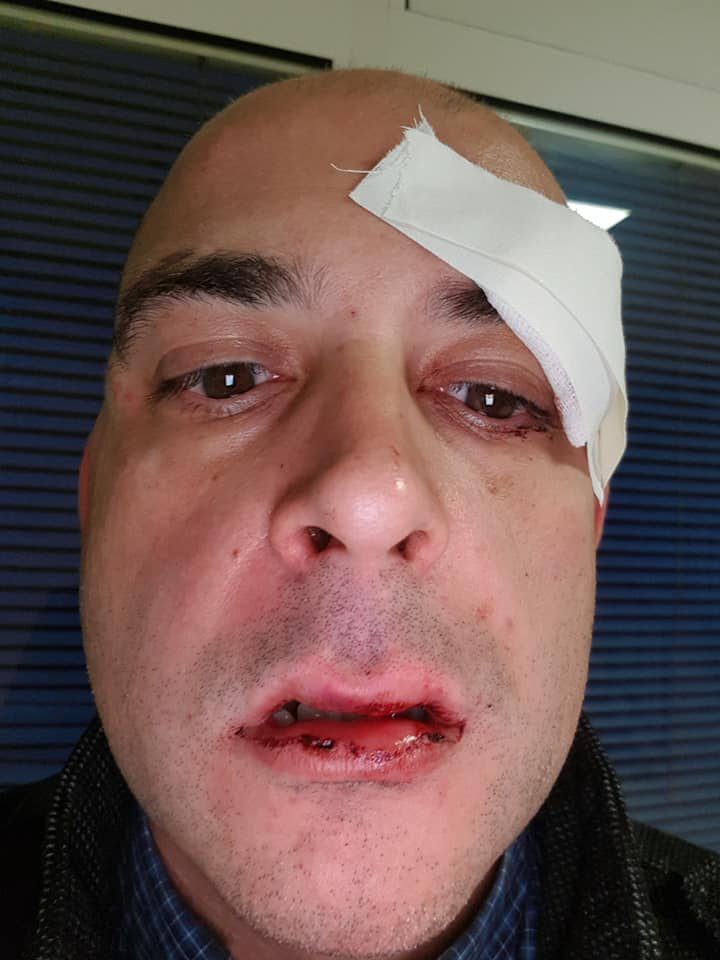 Serbia: The victim had been holding a dog carrier - while his wife was nearby with the dog