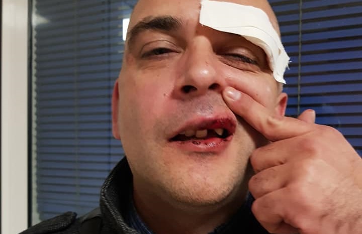 Man carrying pink dog bag beaten up because thugs thought he was gay