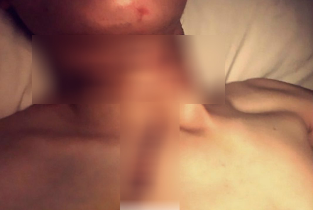 Man in Switzerland slashes his 17-year-old son's throat for being gay