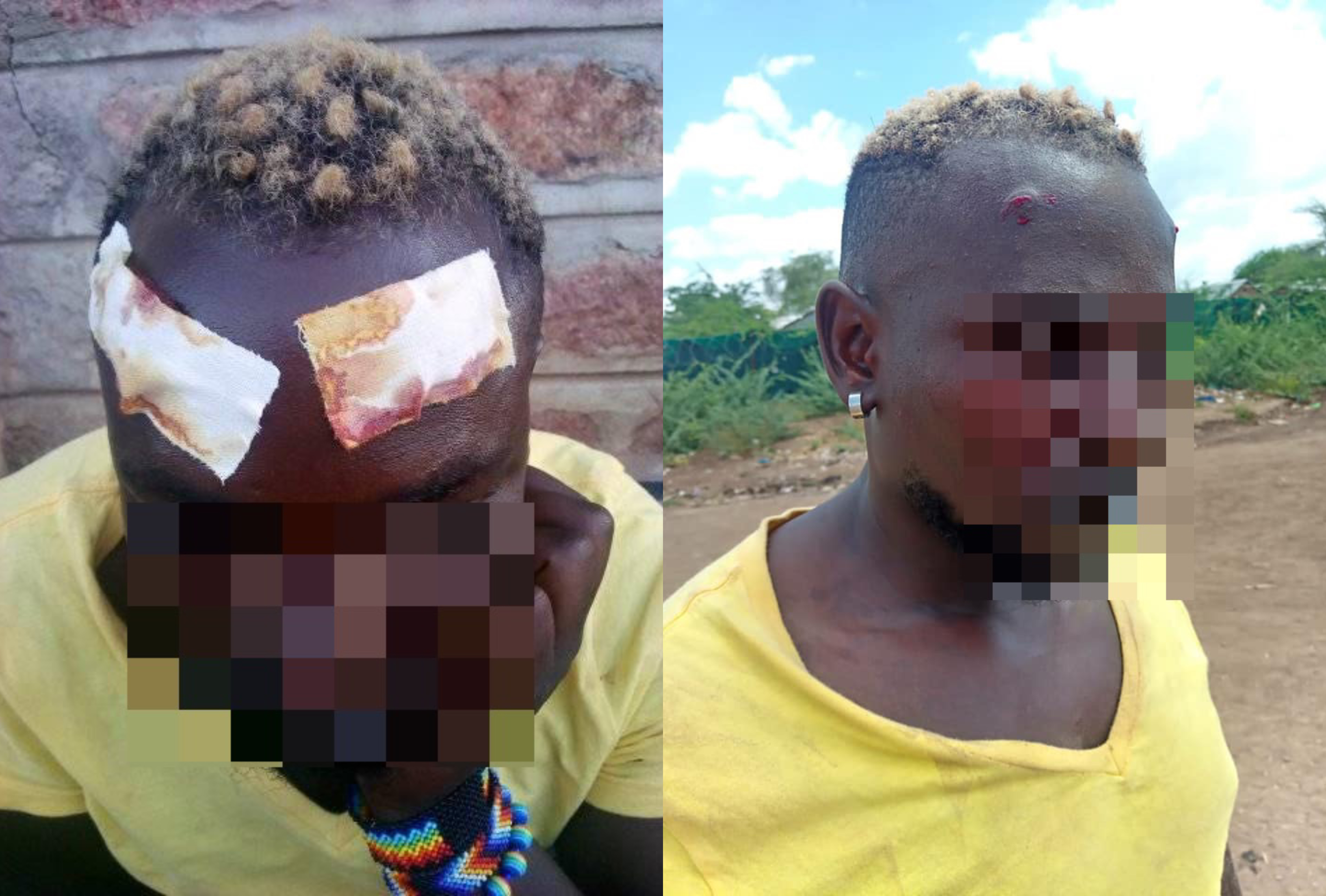 Just hours after a trans asylum seeker was attacked by a mob, homophobes pelted LGBT refugees with stones