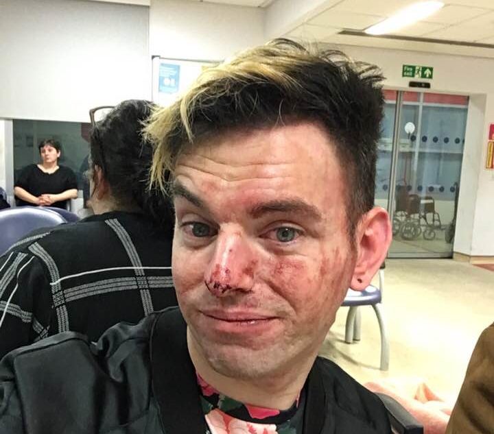 Man hospitalised after bravely defending his two gay friends in brutal and bloody ‘homophobic’ attack