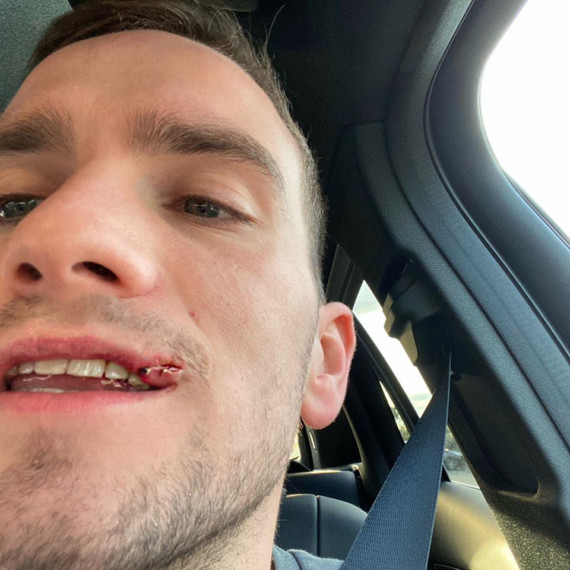 Gay man called 'f****t' and left beaten and bloodied after being falsely accused of flirting