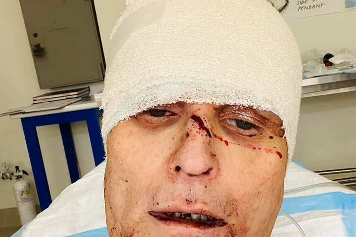 Gay man slashed with meat cleaver and threatened with castration during disgusting homophobic robbery