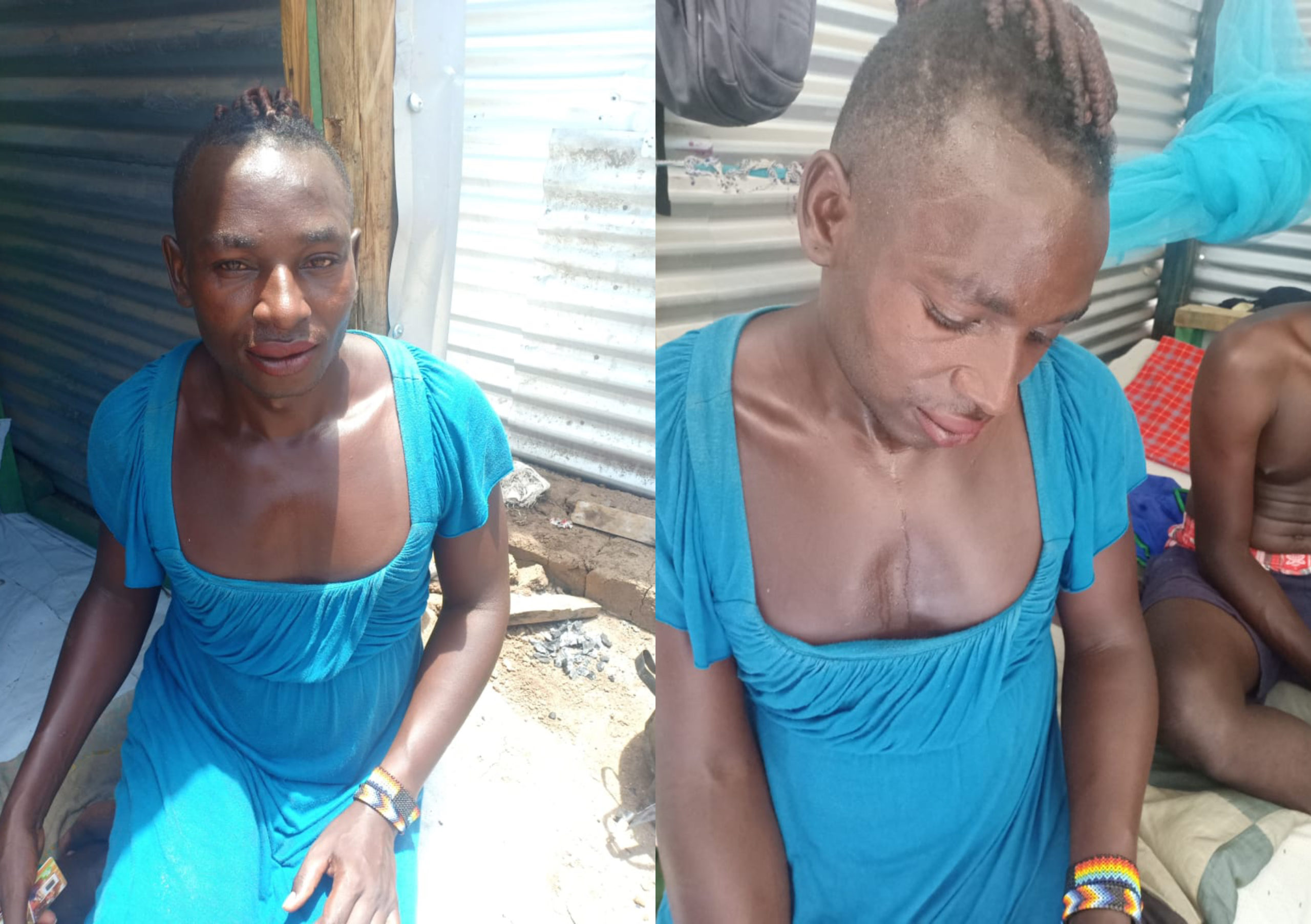 Non-binary Ugandan asylum seeker viciously attacked by gang of thugs for simply wearing a dress