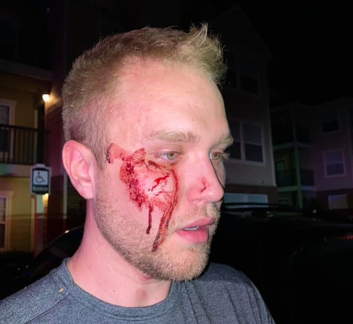 Thugs beat a gay man unconscious while screaming homophobic slurs. Police are refusing to recognise the attack as a hate crime