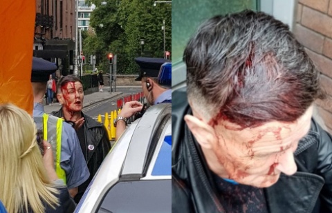 Terrifying video sees trailblazing LGBT+ activist called 'paedo scum' and brutally beaten by far-right anti-mask protesters