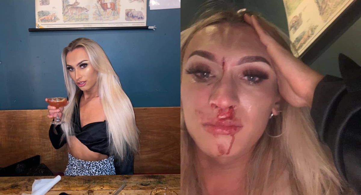 Trans woman left bloodied in sick attack at her table while enjoying a night out with her boyfriend