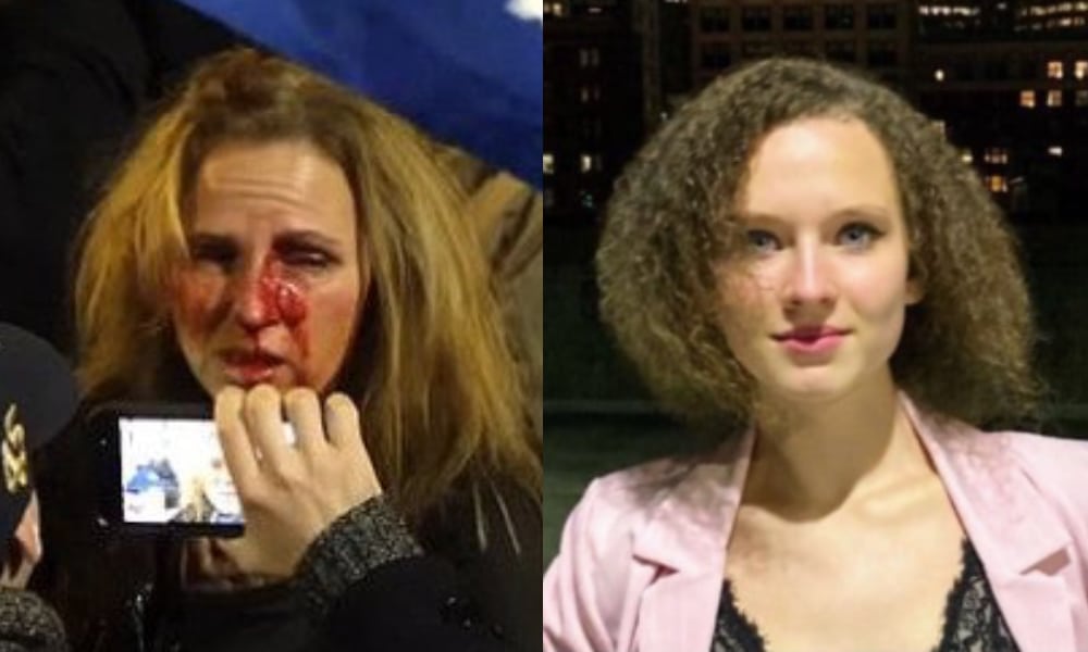 Violent MAGA mom fired after being exposed by lesbian daughter over Capitol clash