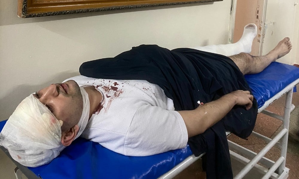 Uzbek LGBT+ activist may need brain surgery after savage attack by masked thugs with a baseball bat