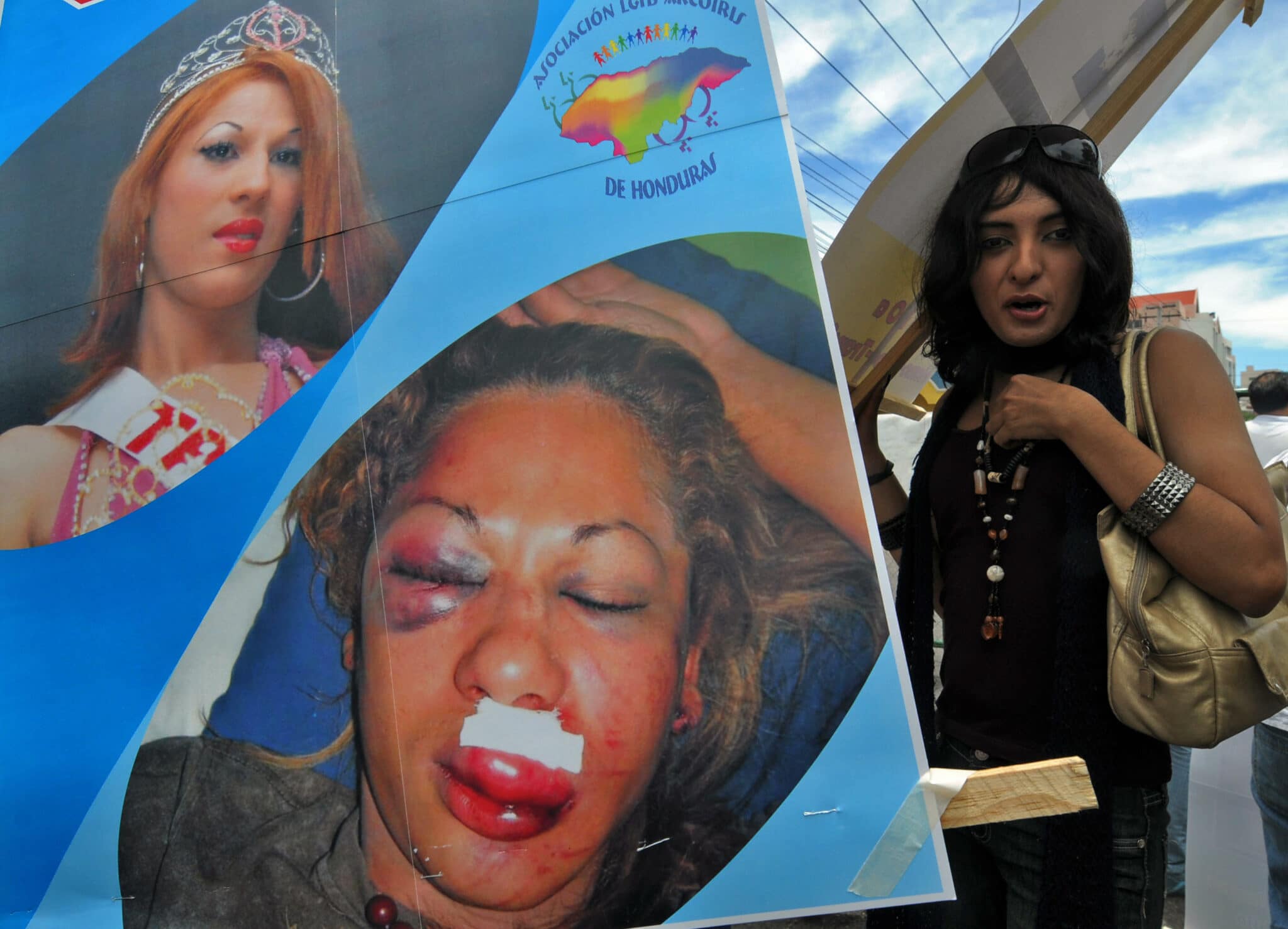 Court could force Honduras to stop heinous, horrifying 'social cleansing' of trans people