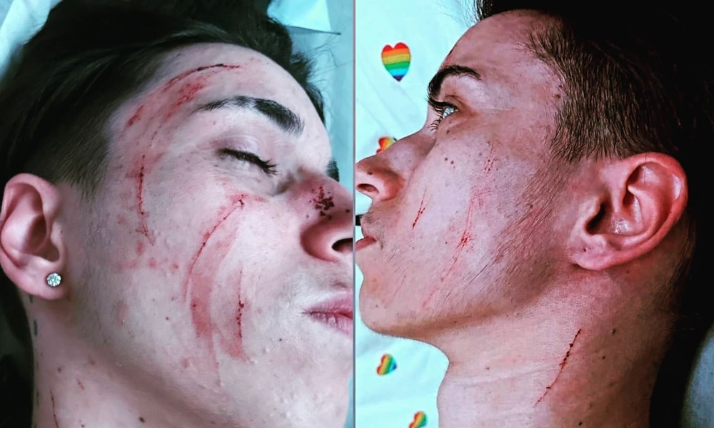 Young trans man attacked at knifepoint before thugs tore off his underwear: 'I thought I was going die'