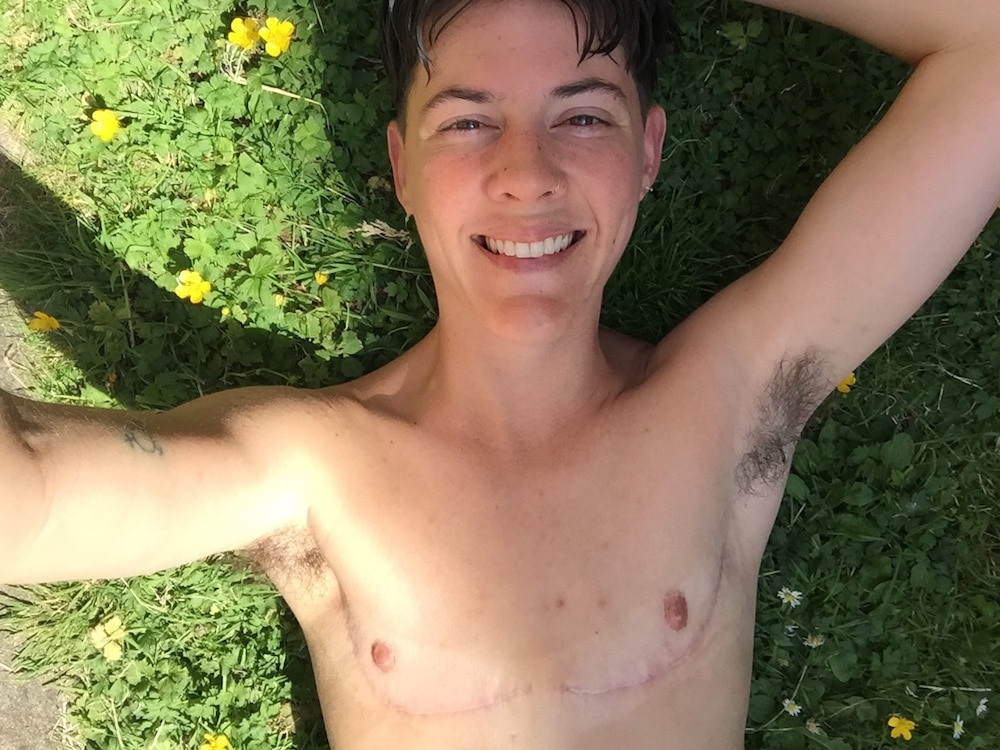 Having top surgery as a non-binary person was how I fell in love with myself for the first time