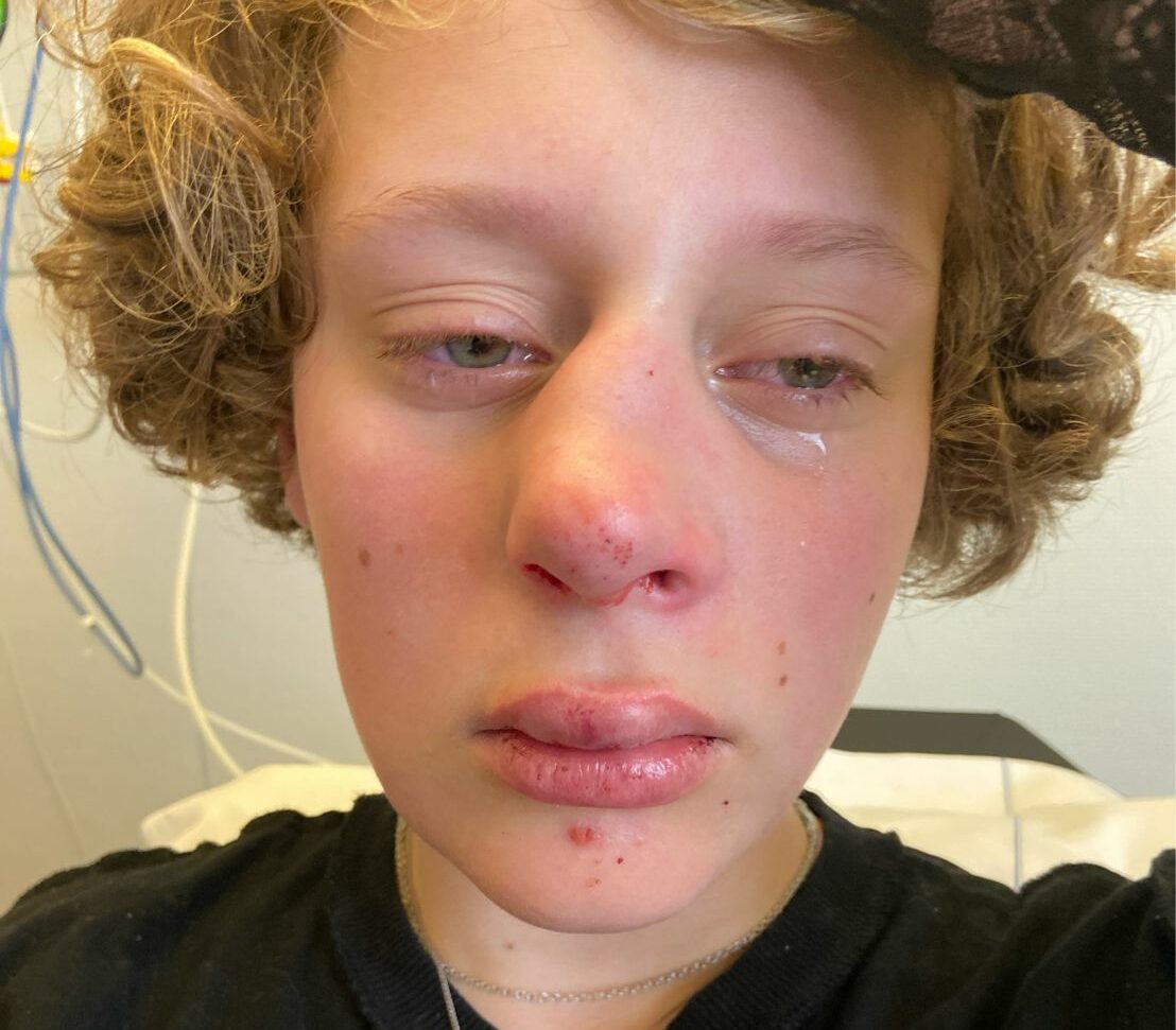 Teen left with broken nose and fractured jaw for refusing to answer 'are you a boy or a girl?'