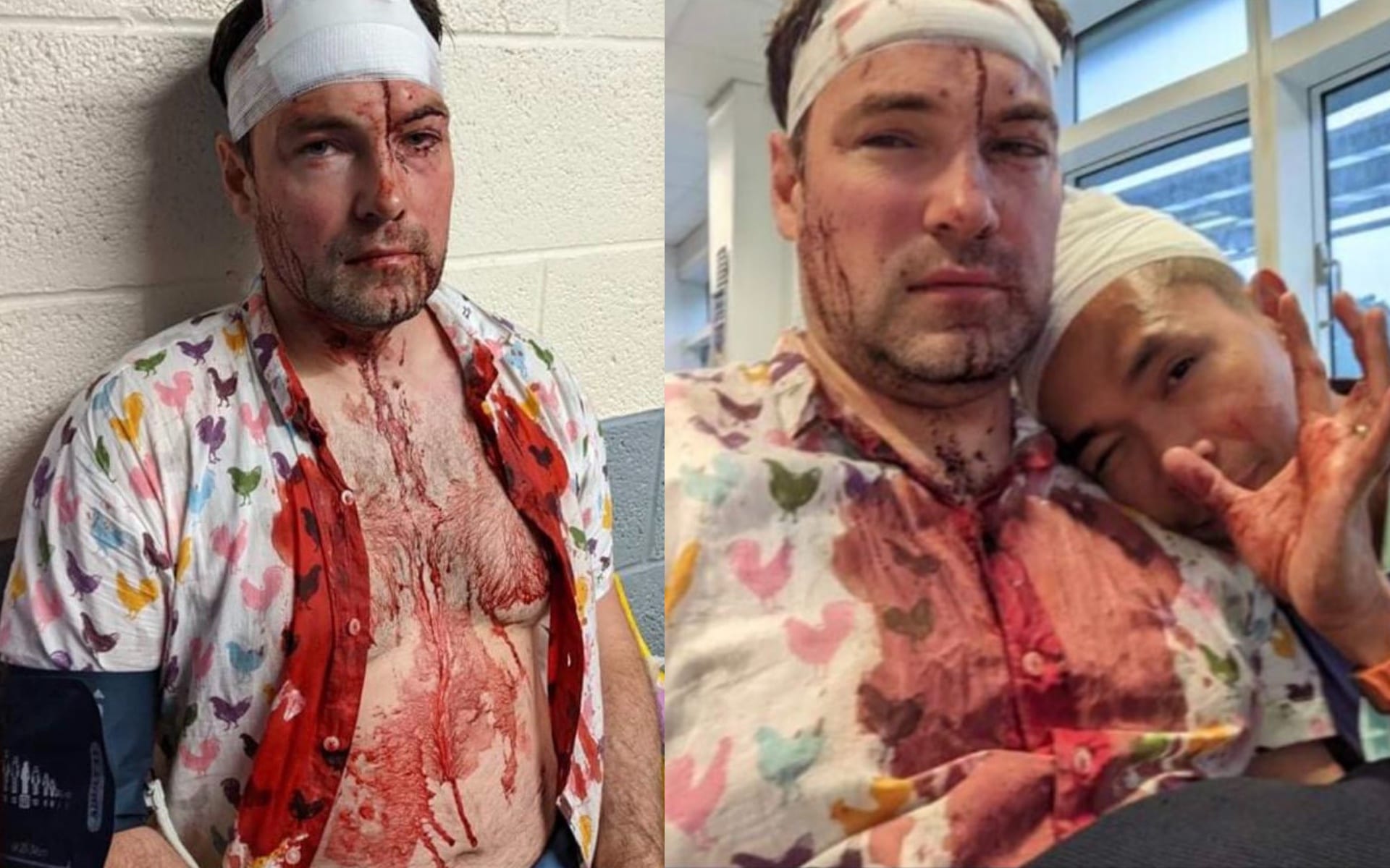 Police arrest three suspects after horrific Birmingham Gay Village attack