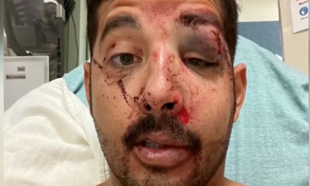 Two men knock gay man unconscious in violent hate crime: 'You never expect it to happen to you'