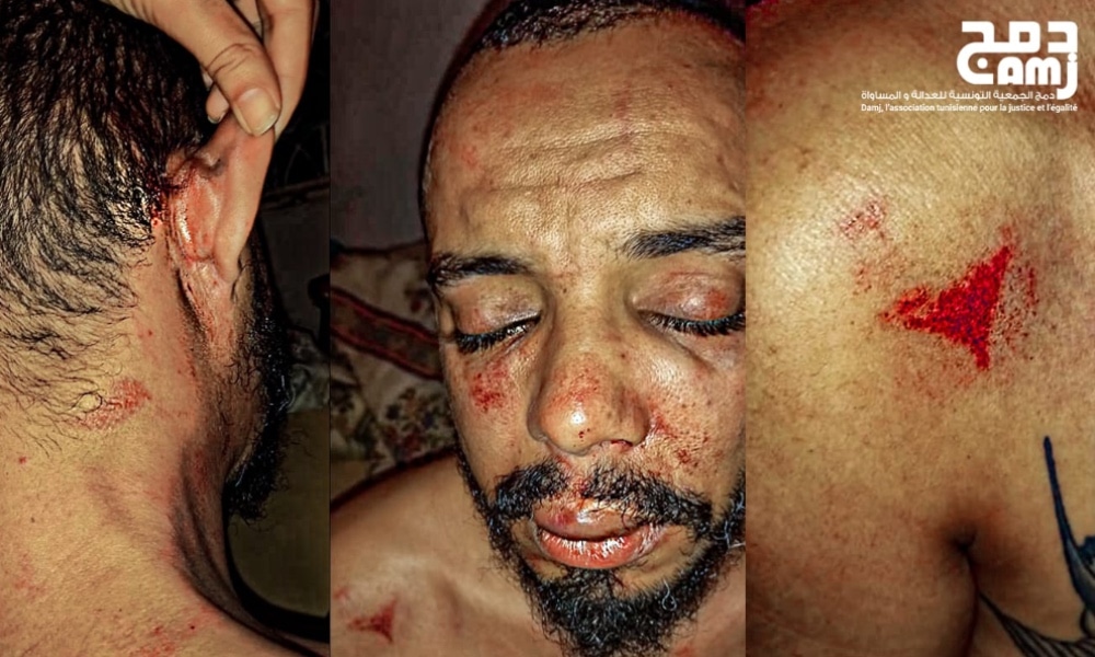 Man dressed in police uniform stood on Tunisian activist's neck in chilling attempt to 'silence' him