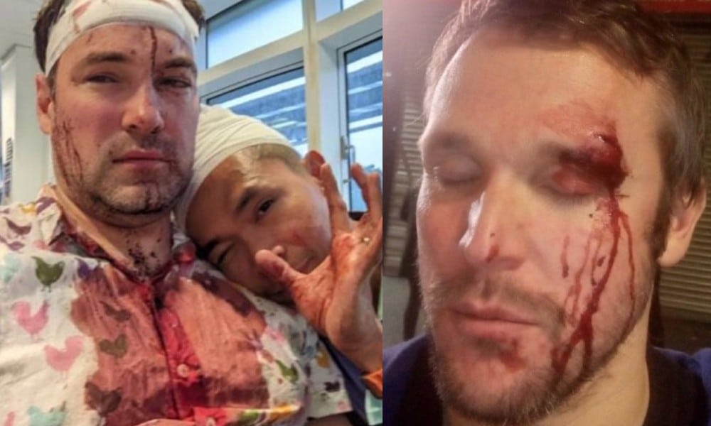 Birmingham leaders announce major steps to combat spike of anti-LGBT+ violence