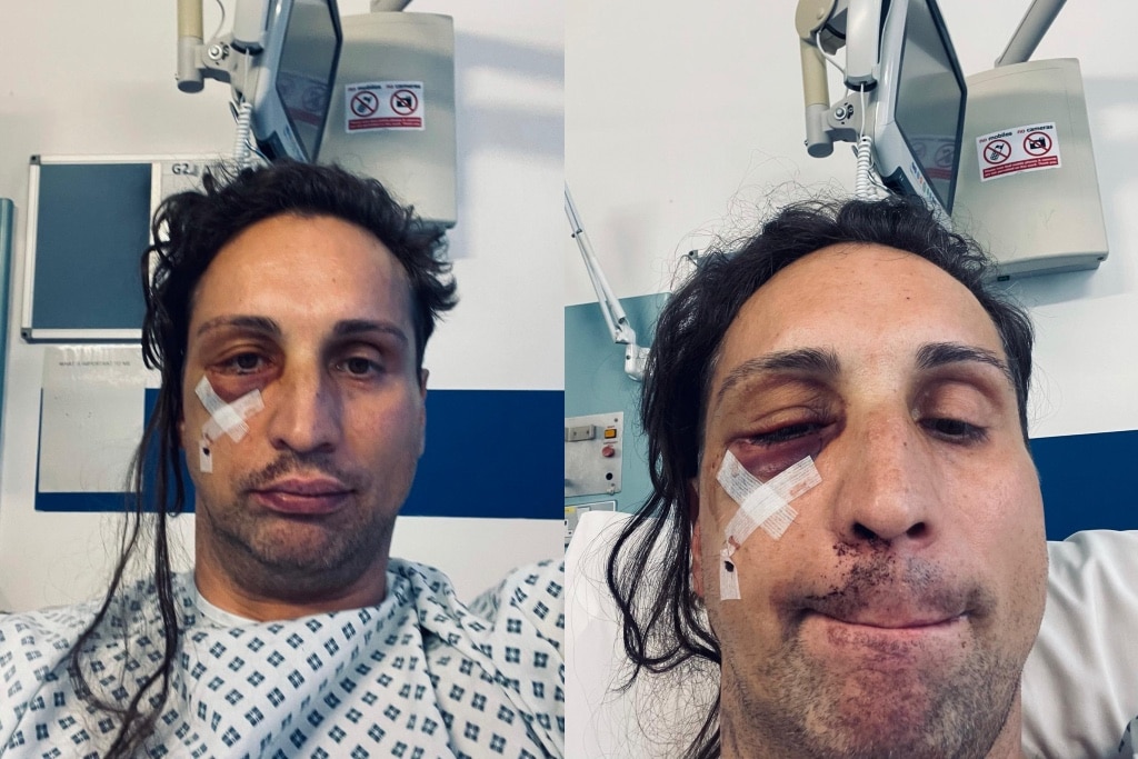 Gay man afraid to leave his house after being hit with hammer in brutal 'homophobic hate crime'