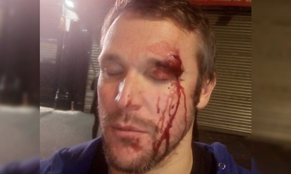 Suspect arrested after gay man beaten with glass bottle in 'hate-motivated' attack